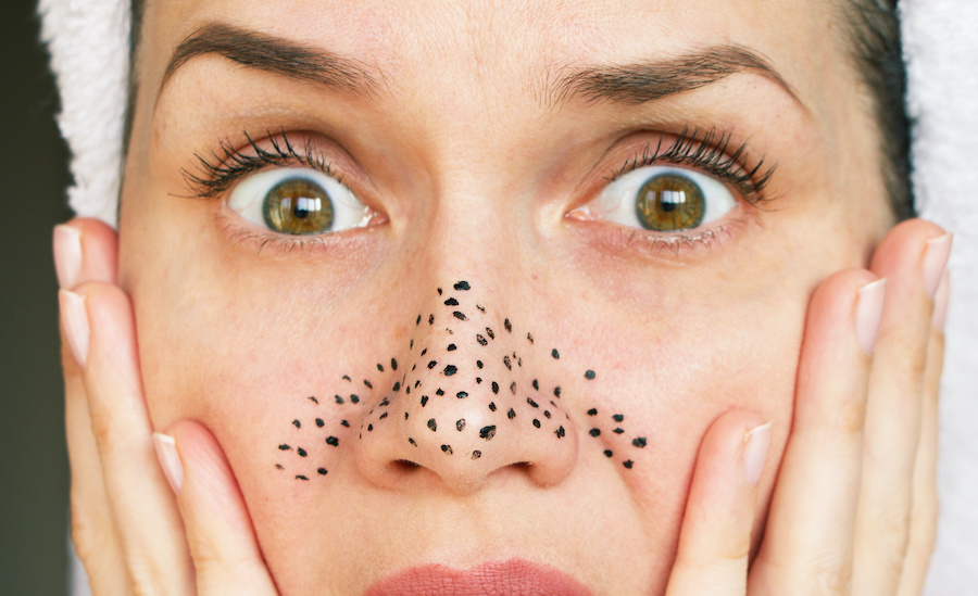 Talg Stoppen Everything You Need To Know Rencana