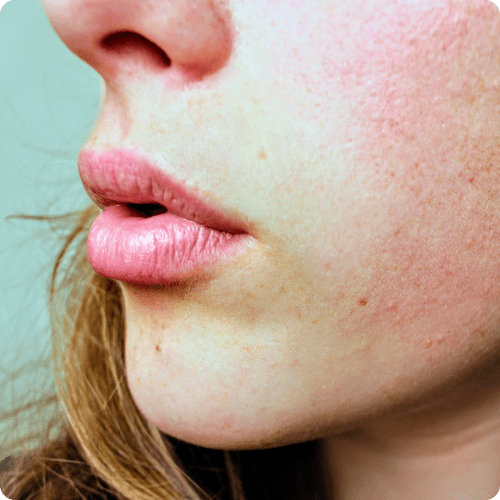 What Causes Itchy Skin in Winter