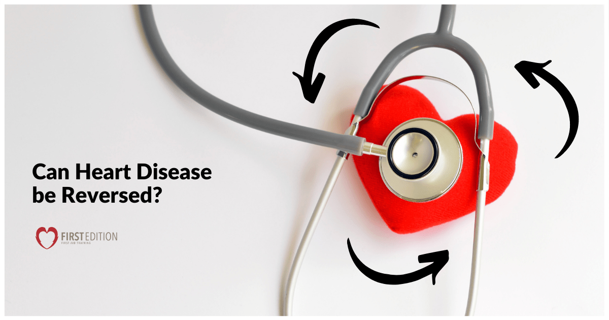 Can Heart Disease be Reversed? First Edition AED Calgary
