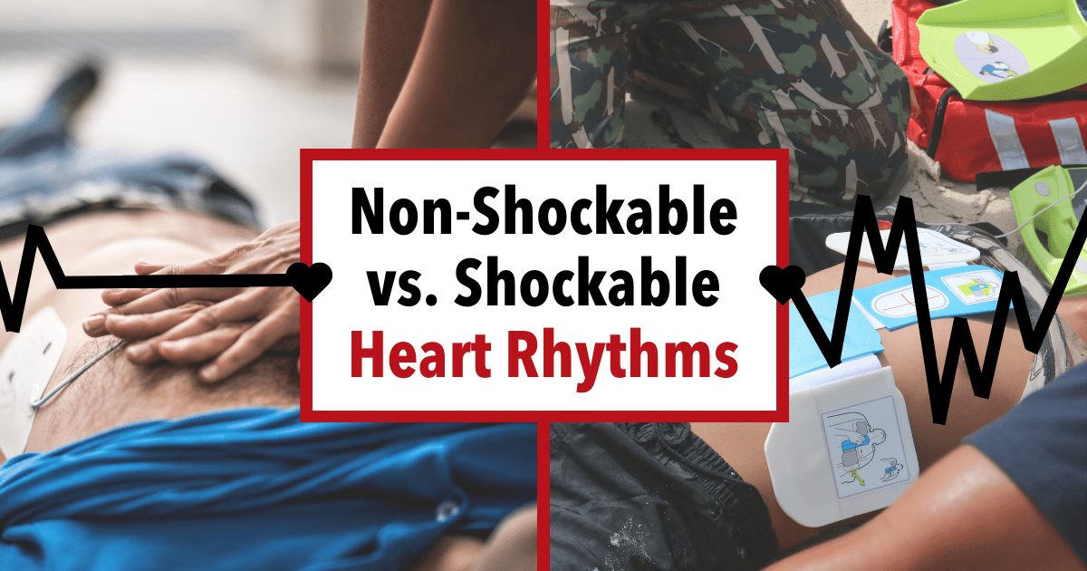 Understanding NonShockable vs. Shockable Heart Rhythms