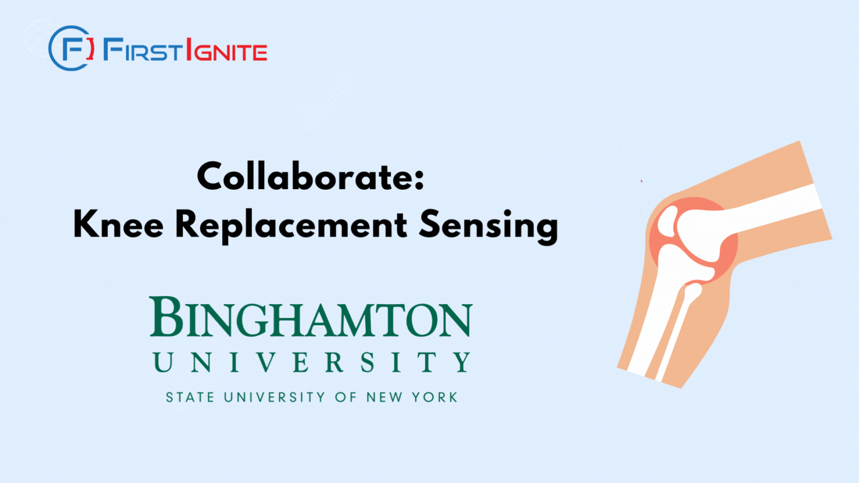 Collaborate Knee Replacement Sensing FirstIgnite