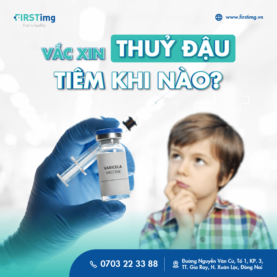 Vắc xin Thủy đậu tiêm khi nào?