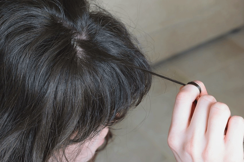 Trichotillomania A Guide to Diagnosis and Treatment