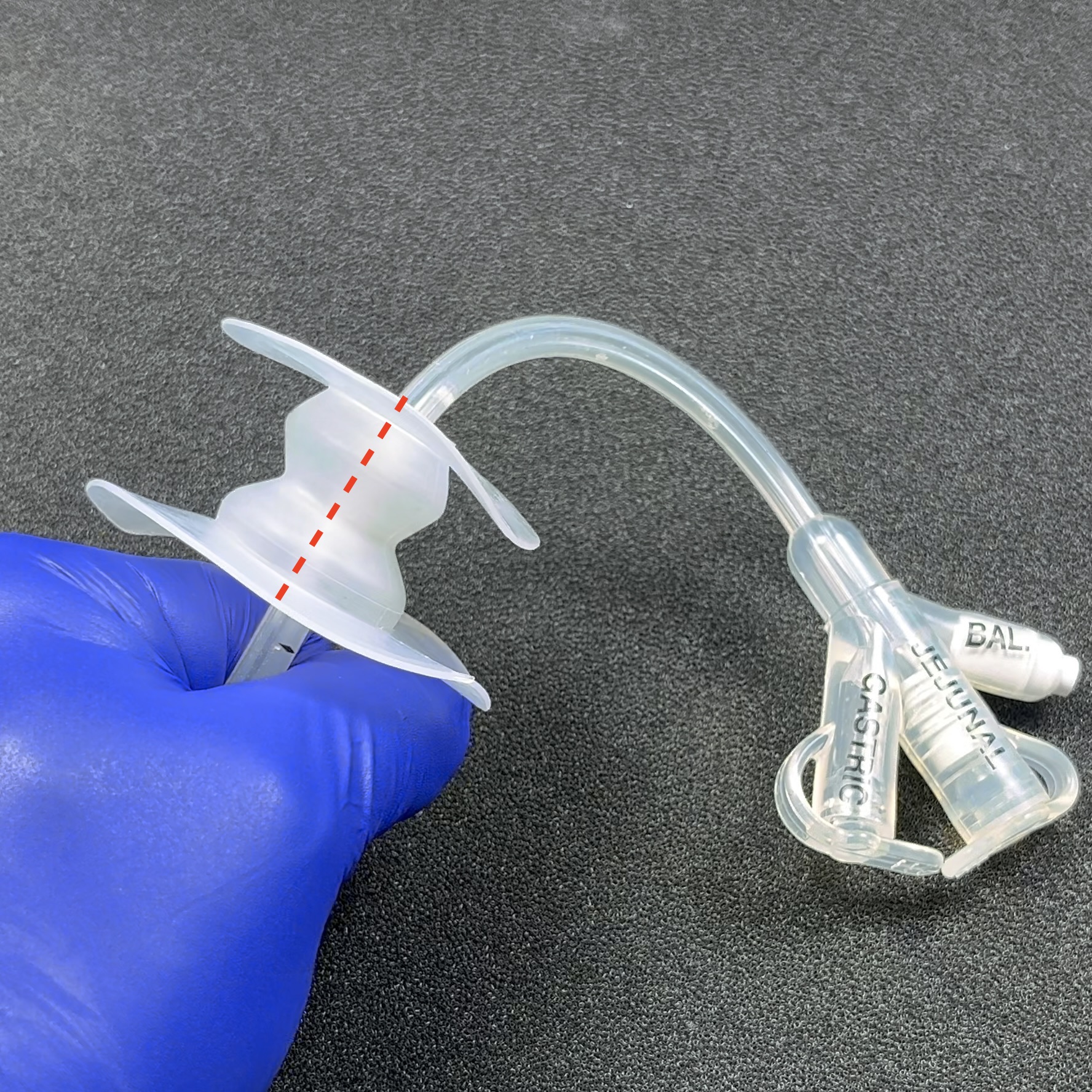Stabilize PEG Tubes and Wound Drains to Reduce Insertion Site Leakage Fistula Solution