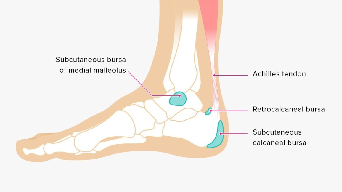 So What Is Calcaneal Bursitis? Fit2Function Clinics