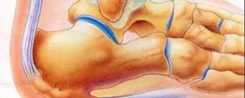 Web most people who have plantar fasciitis recover in several months with. Web plantar fasciitis commonly causes pain in the centre and inner side of the heel. plantar fasciitis