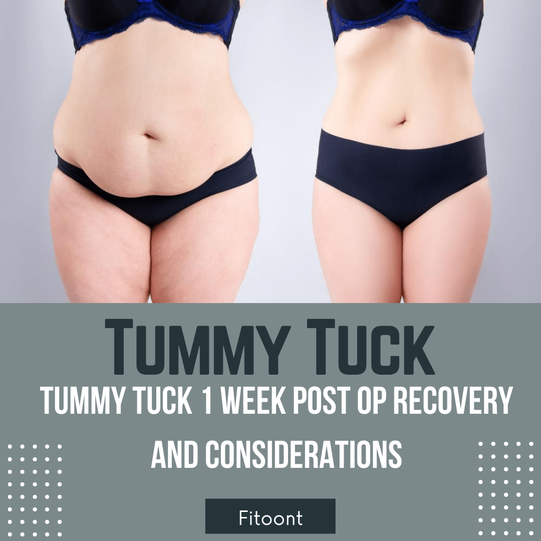 Tummy Tuck 1 Week Post Op Recovery and Considerations Fitoont