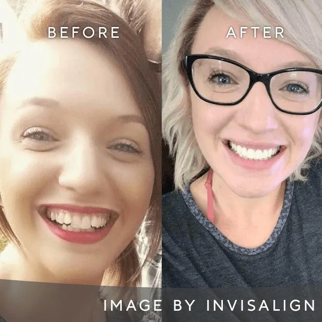 Cosmetic Dentistry Fitzwilliam Street Dental Care