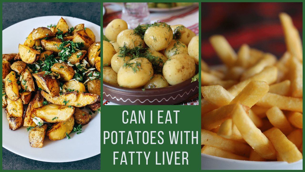Can You Eat Potatoes With Fatty Liver? Fatty Liver Treatment & Diet