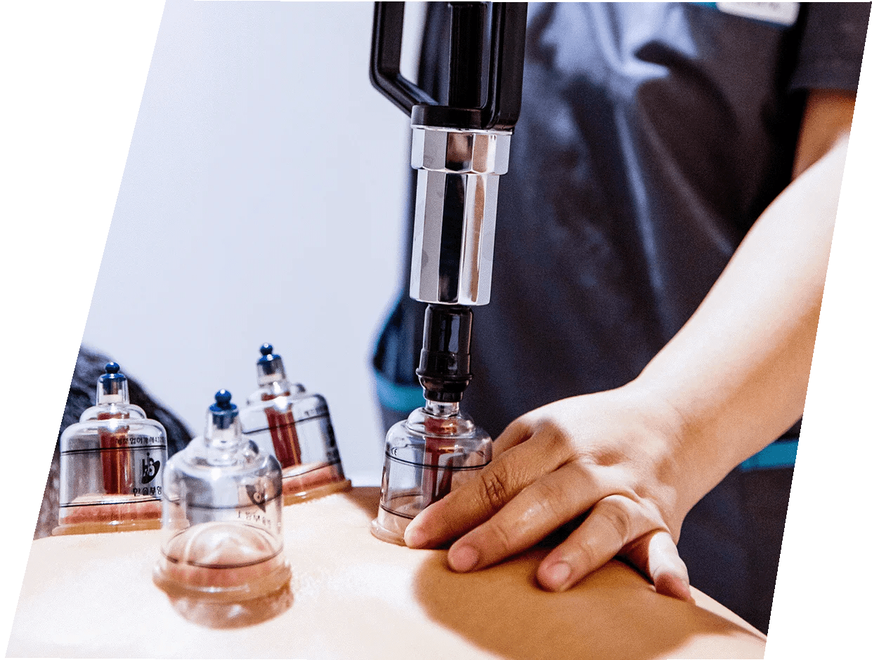 Cupping Massage Cedar Rapids at Mariko Drummond blog