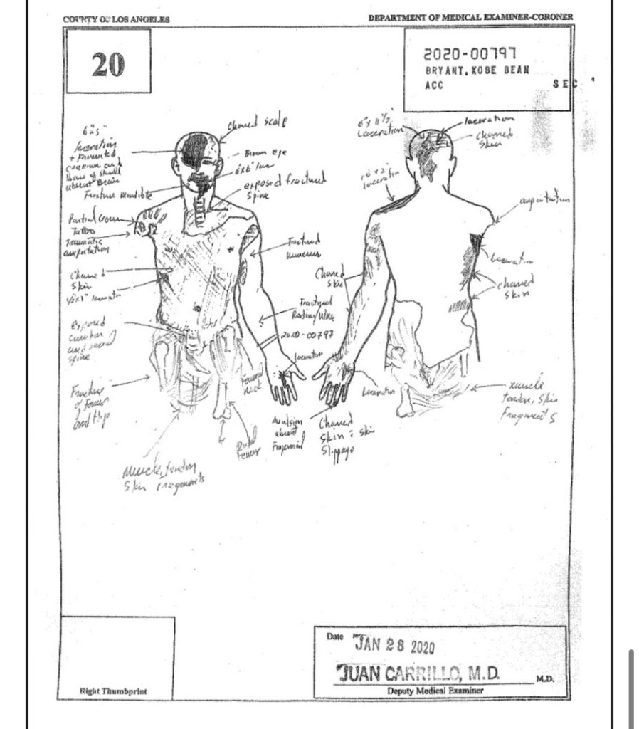 Gigi Autopsy Sketch Cause Of Death Report And Photos Fixthelife