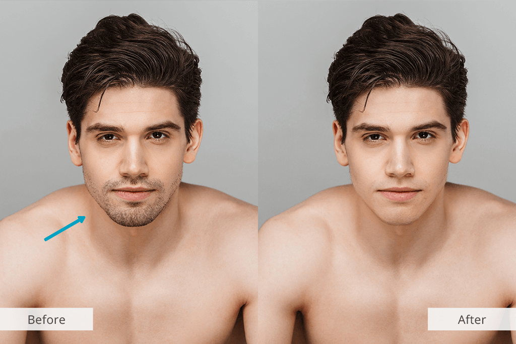 Beard Removal App for iOS and Android