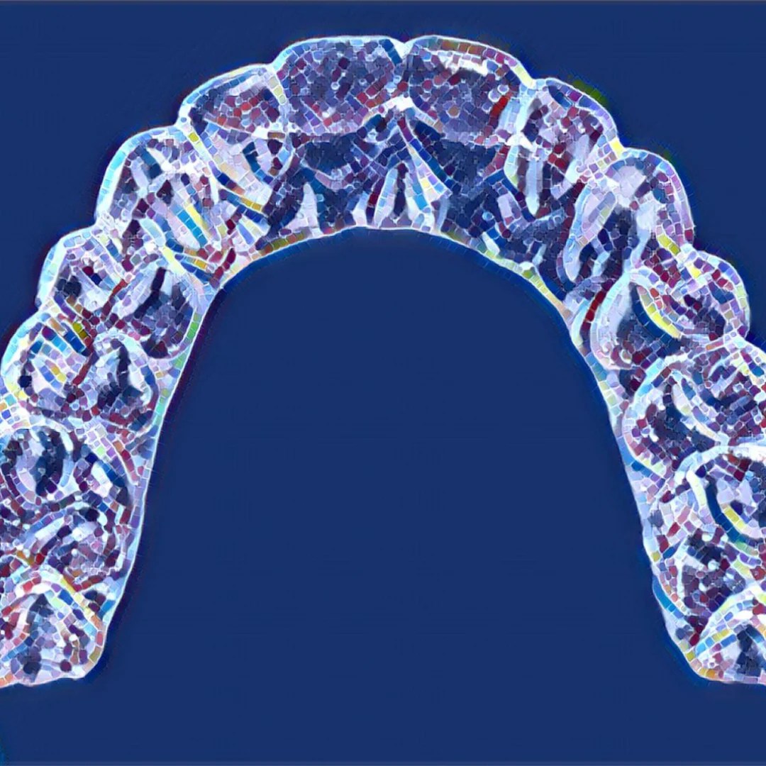 How to Clean Invisalign Trays? fizzyoral