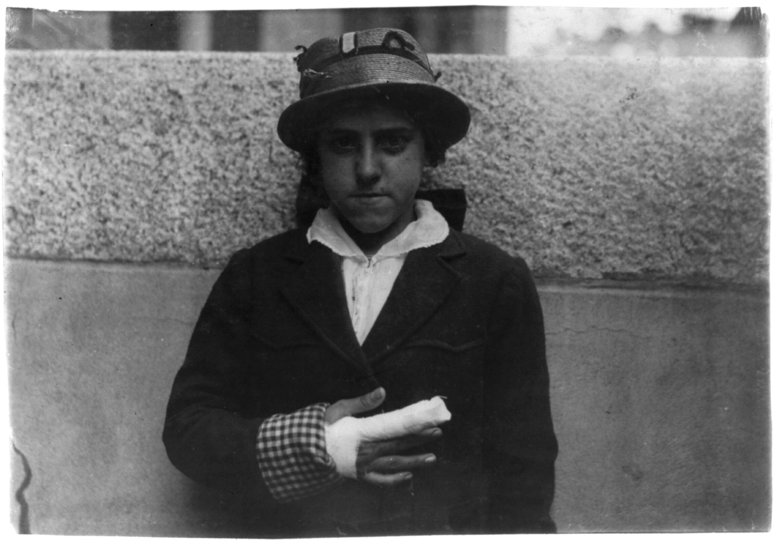 The Industrial Revolution Child Labor Accidents