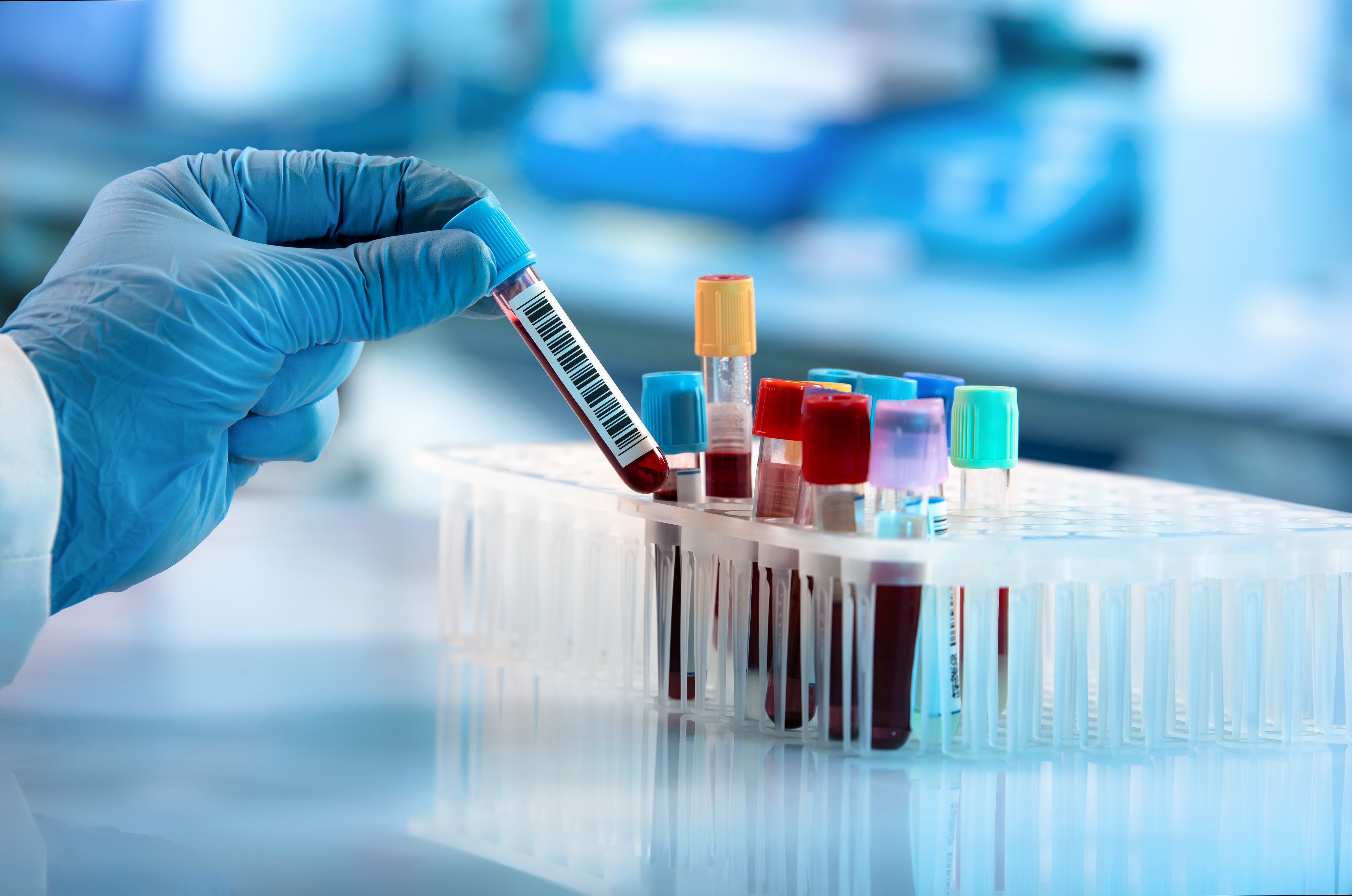 Technician holding blood tube test in the research laboratory / doctor