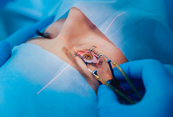 LASIK Introduction Fort Lauderdale Eye Institute