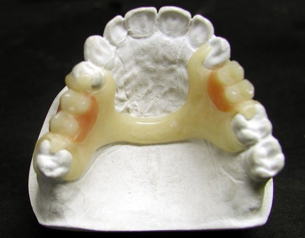 FlexiteProductsFlexible Partial Dentures Flexite Flexible Partial