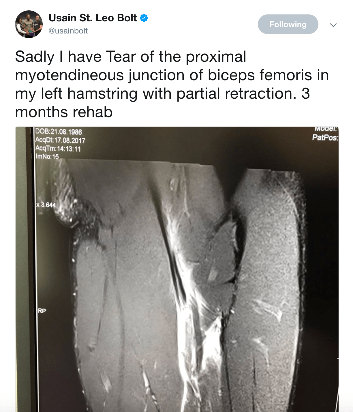 Usain Bolt Reveals Hamstring Tear Diagnosis FloTrack