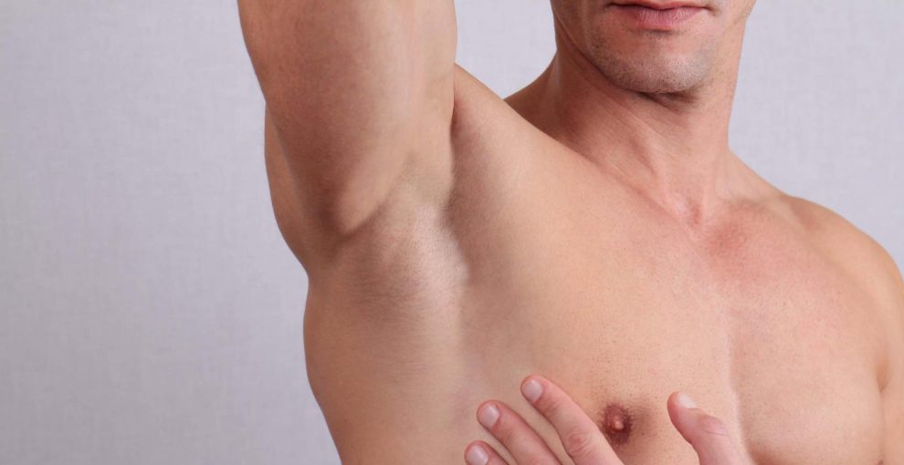 Laser hair removal in Brandon and Tampa Bay, FL. Cost of laser hair removal