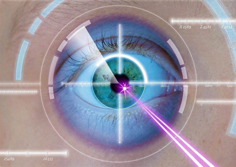 Laser Eye Surgery and What to Expect Florida Eye