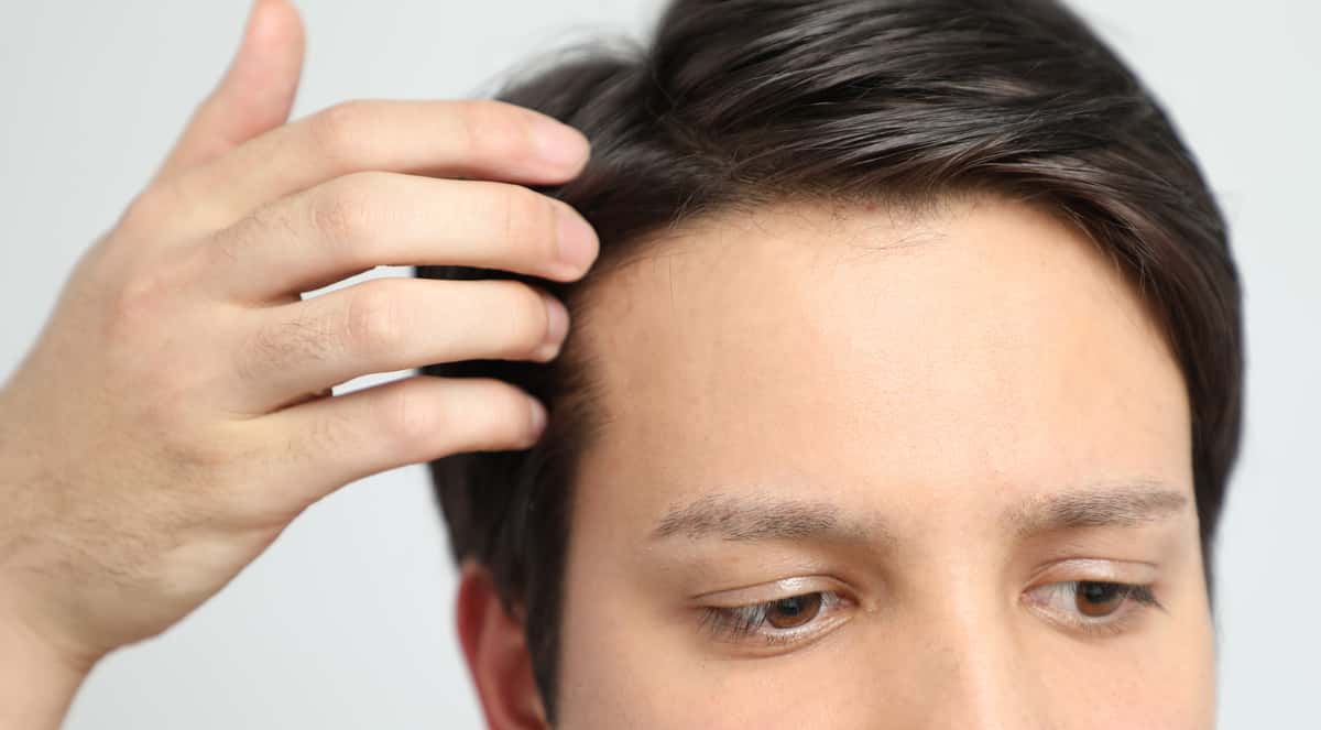 How Do Hair Implants Work? Florida Independent