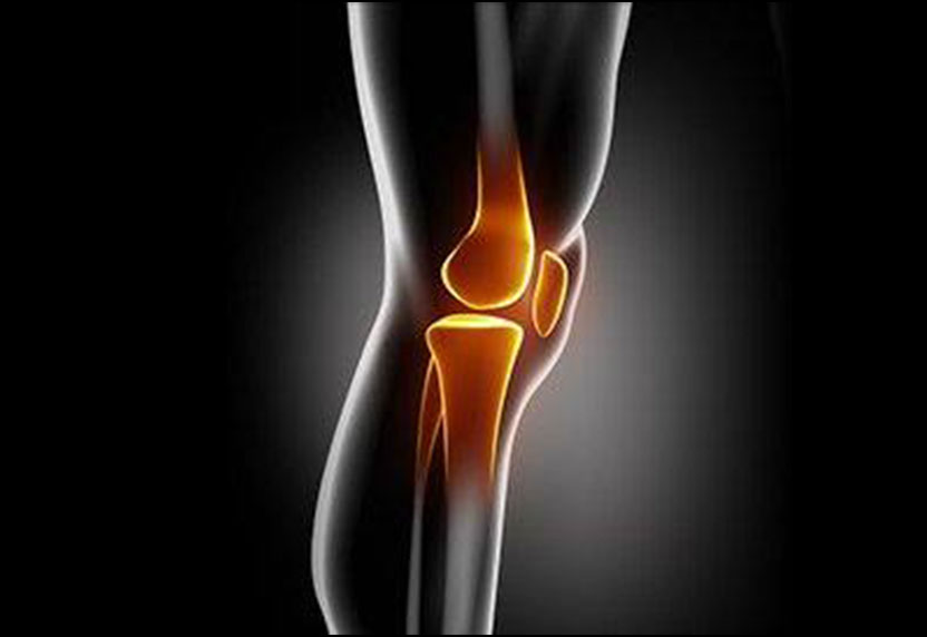 Visionaire Knee Replacement Florida Ortho Care