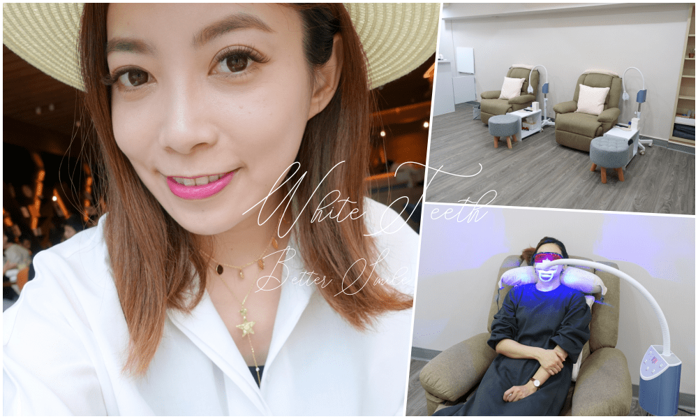 【美齒】出國旅遊前的藍光美齒@Dr.曾 淨白美齒專家