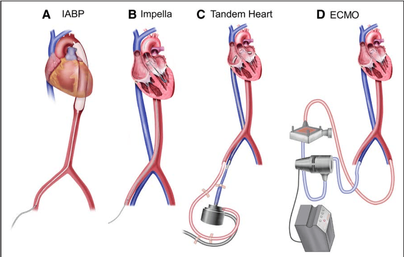 3rd BEACH Course Session 1 The International Fluid Academy