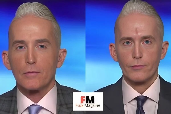 Did Trey Gowdy Have Forehead Surgery Everything You Need To Know