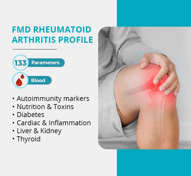 Blood Test For Arthritis Levels at Catherine Arellano blog