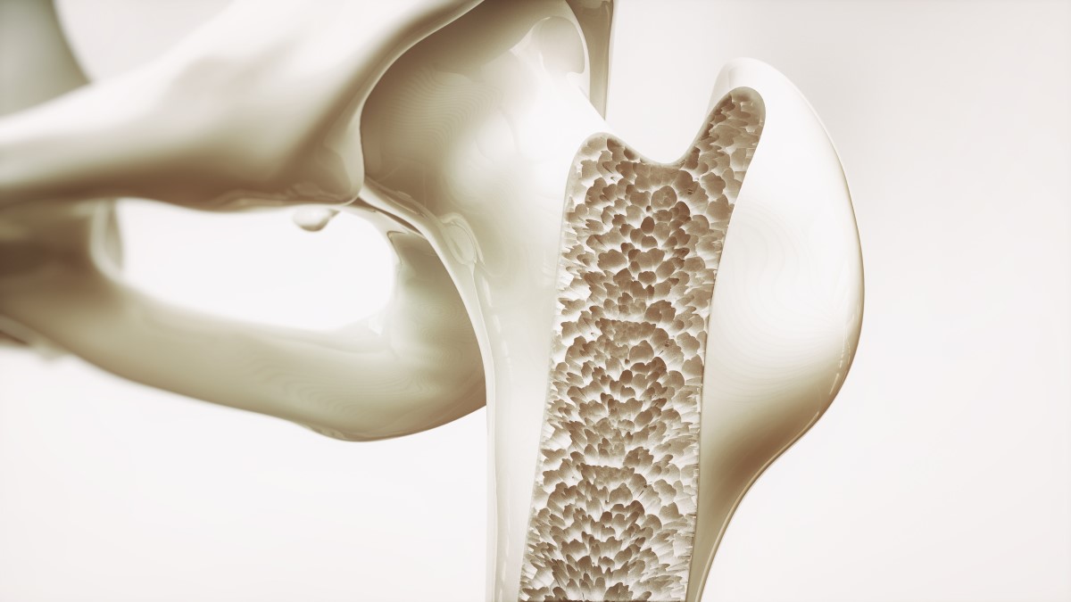 What is Osteoporosis? Family Medicine & Geriatric Center