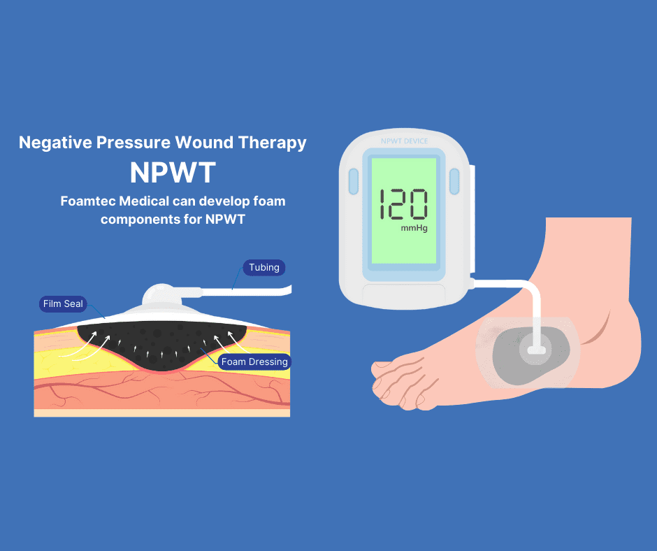 Use of Foam in Negative pressure wound therapy (NPWT) Foamtec Medical