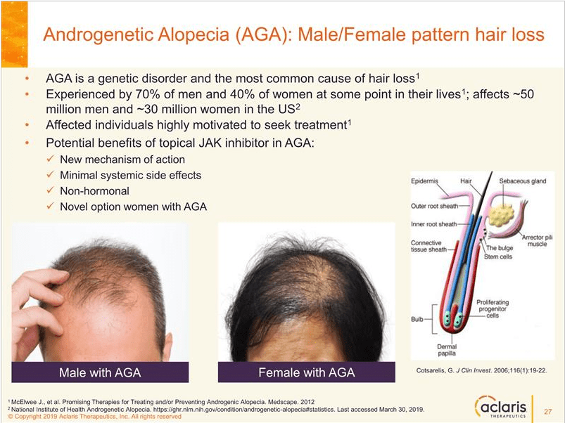 Follicle Thought Page 9 Hair Growth Treatment News Hair Loss Cure