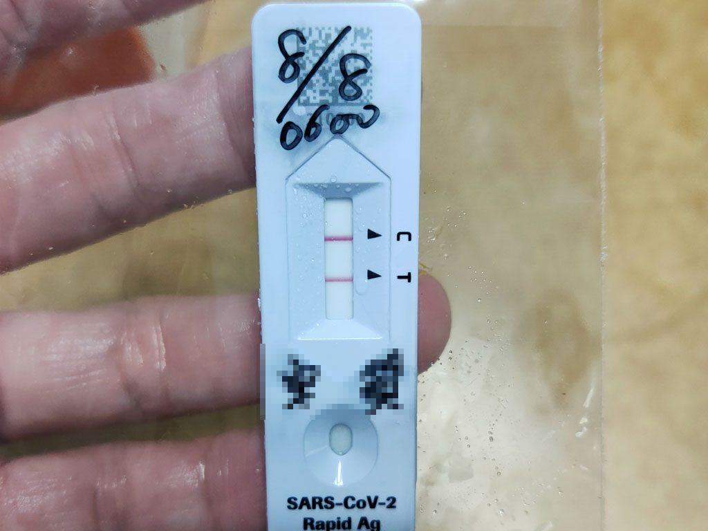 covid-19之…我也確診了