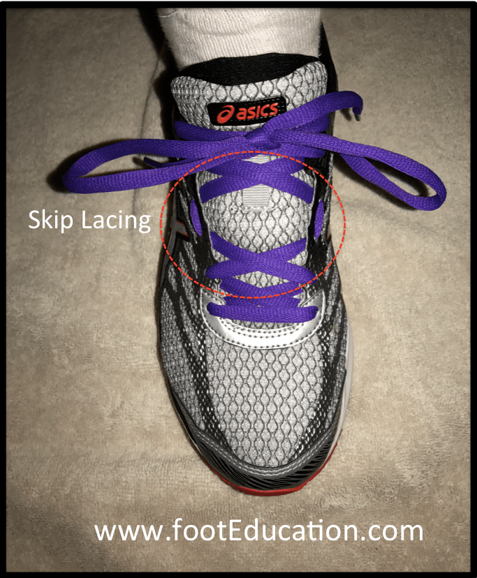 Tarsal Boss FootEducation