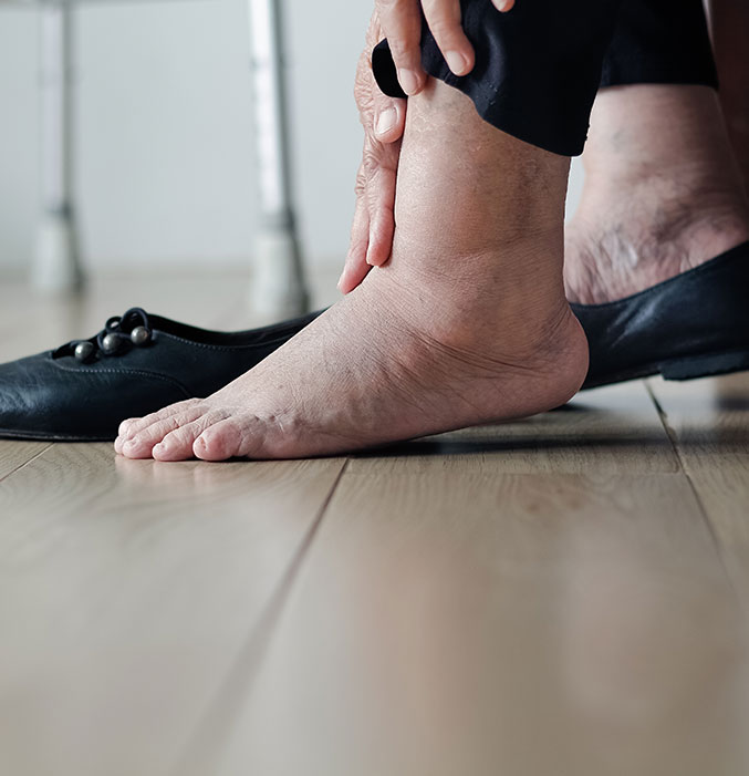 Diabetic Foot Footlogics Orthotics