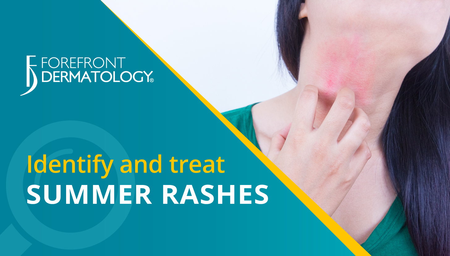 How to Identify and Treat Summer Skin Rashes Forefront Dermatology