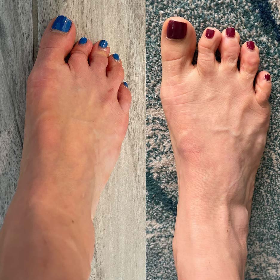 My Foot Function Foot Health, Foot Health Courses, Online Training