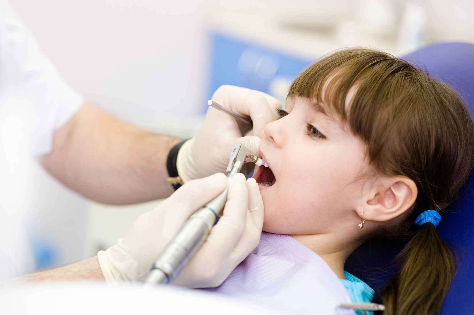 What to Do if Your Child Chipped a Tooth