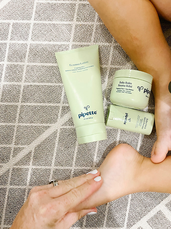 Dry Skin Rash in Winter? Tips from a Pediatrician Forever Freckled