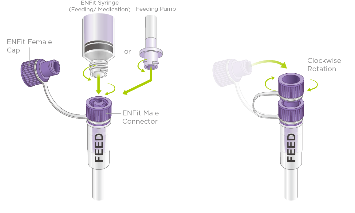 A Brief Introduction of 2023 New Product with ENFit Connector Fortune