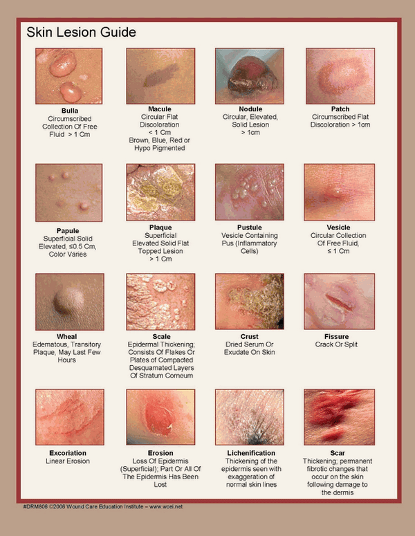 Skin Lesion Guide | Faculty of Medicine