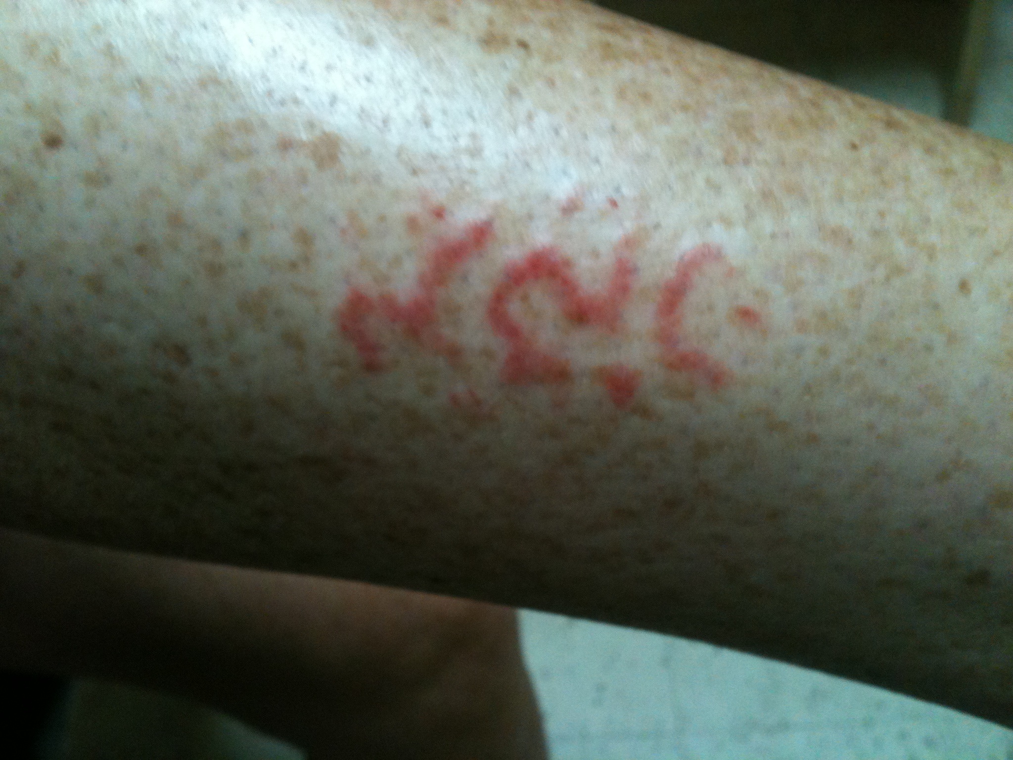 Pruritic Rash Faculty of Medicine