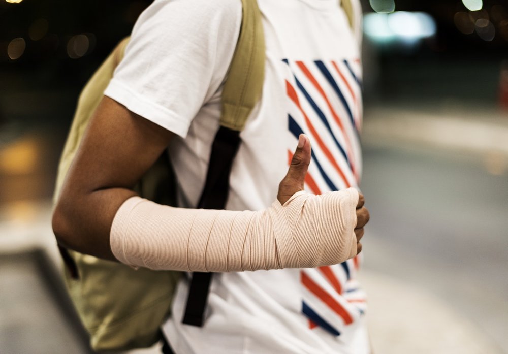 Broke Your Arm? Exercise The Other One To Strengthen It!Study Shows