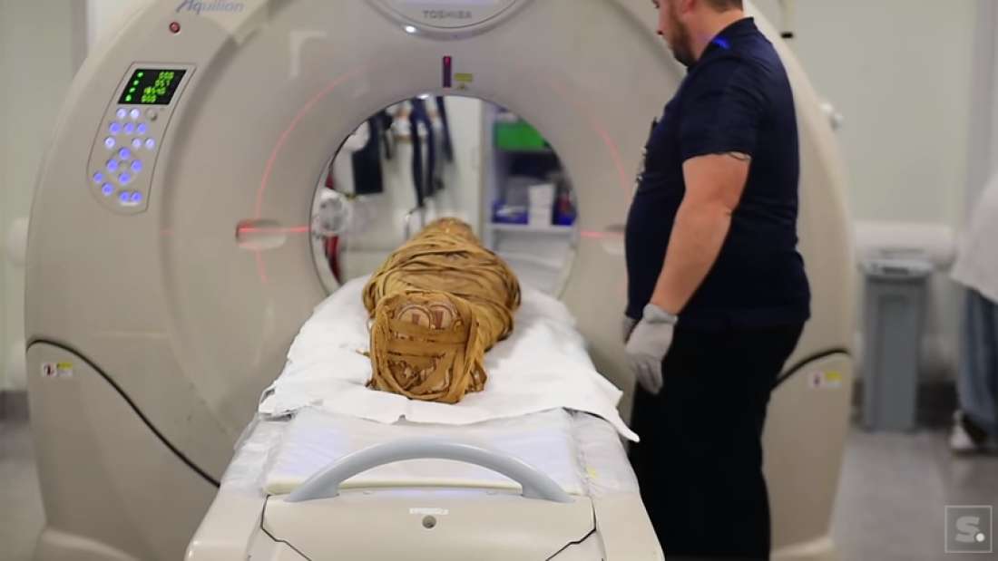 CT Scan Of 2,000YearOld Egyptian Mummy Reveals A Tumor In Its Leg