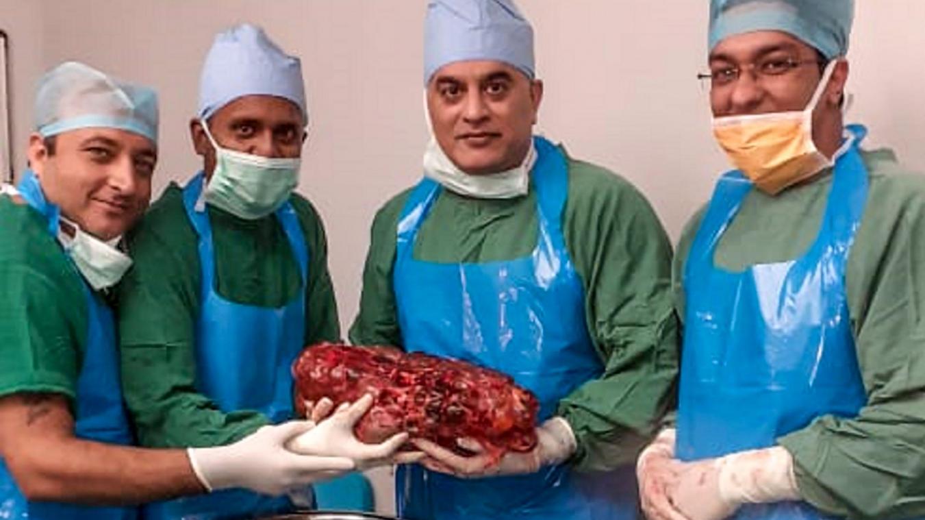India Doctors Remove Kidney That 'Weighs As Much As Two Newborns' From