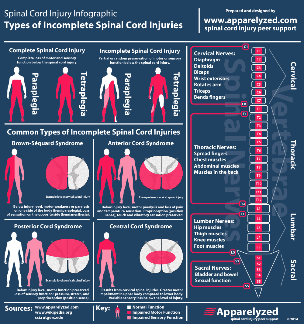 Types of Spinal Cord Injuries Faculty of Medicine
