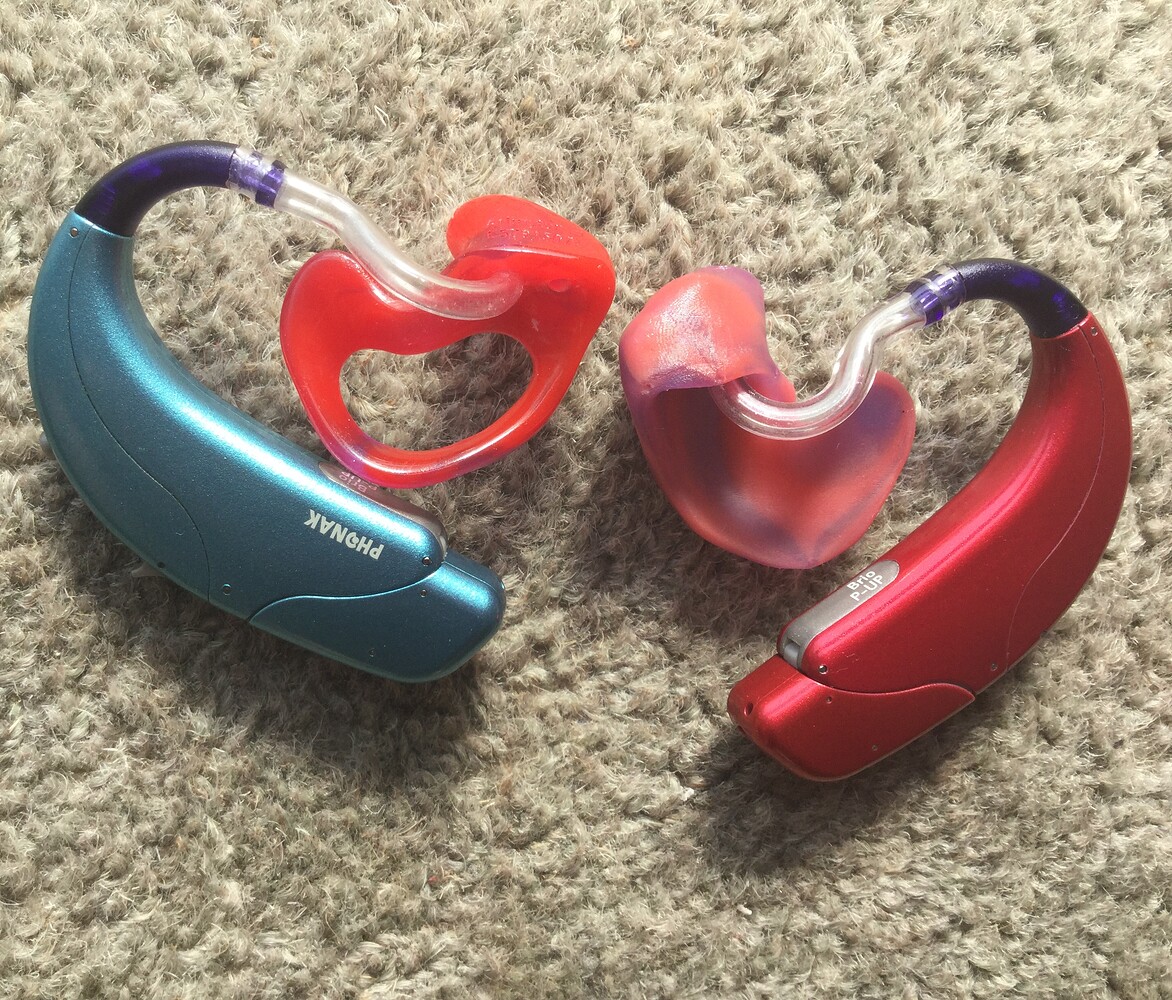 Am I unprofessional because of the colour of my hearing aids