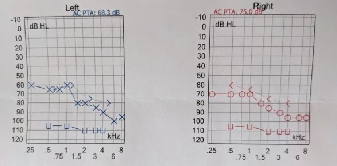 How to translate Costco Hearing Test into HearingTracker format Forum
