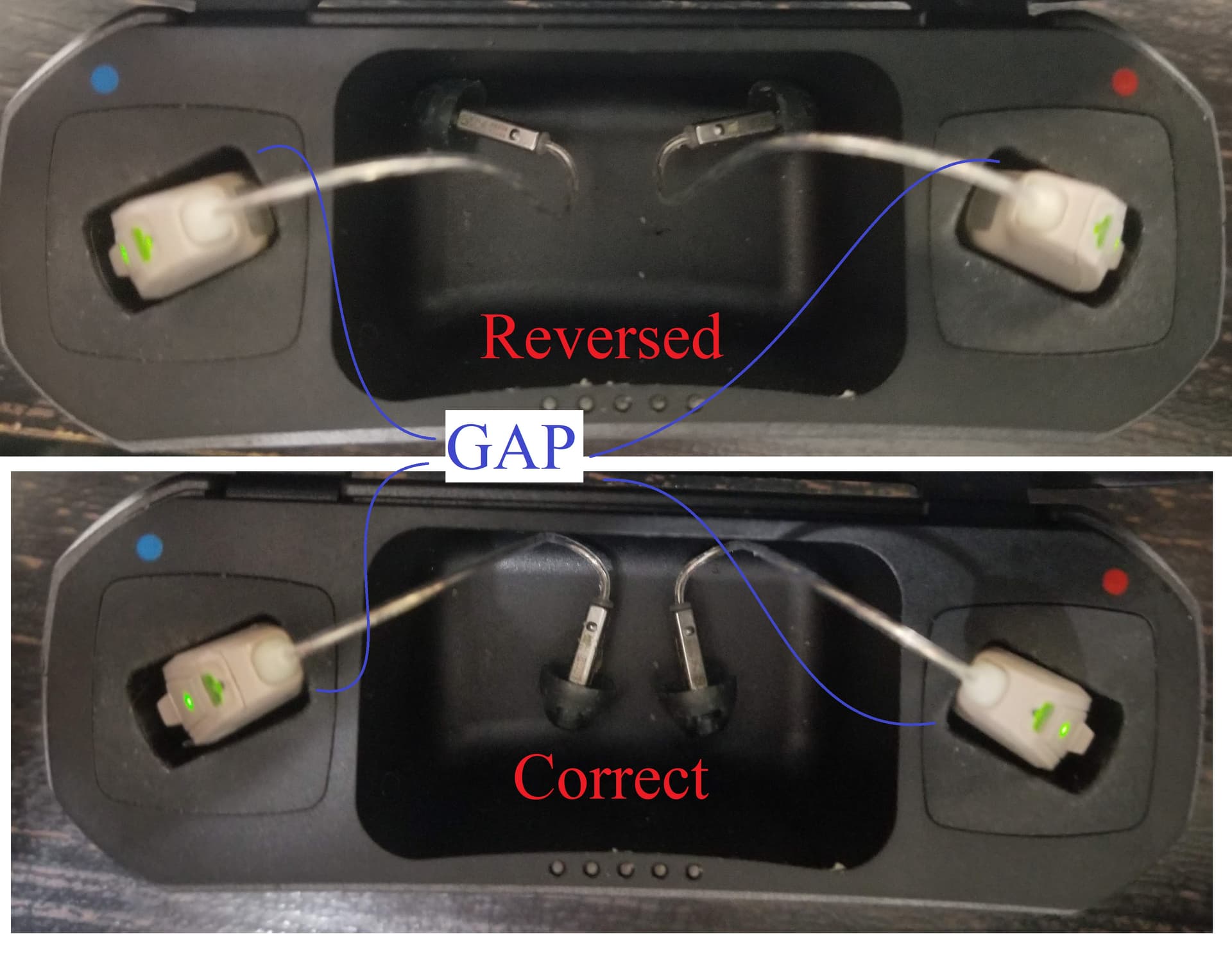 Resound Quattro battery replacement - Manufacturer Support - Hearing
